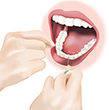 Flossing